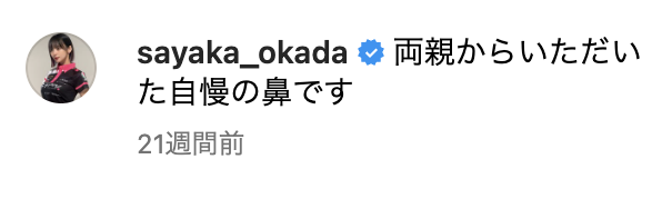 岡田紗佳　整形　鼻　どこ　顔変わった　昔　現在